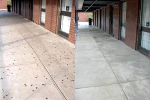 gum removal_before and after Knoxville